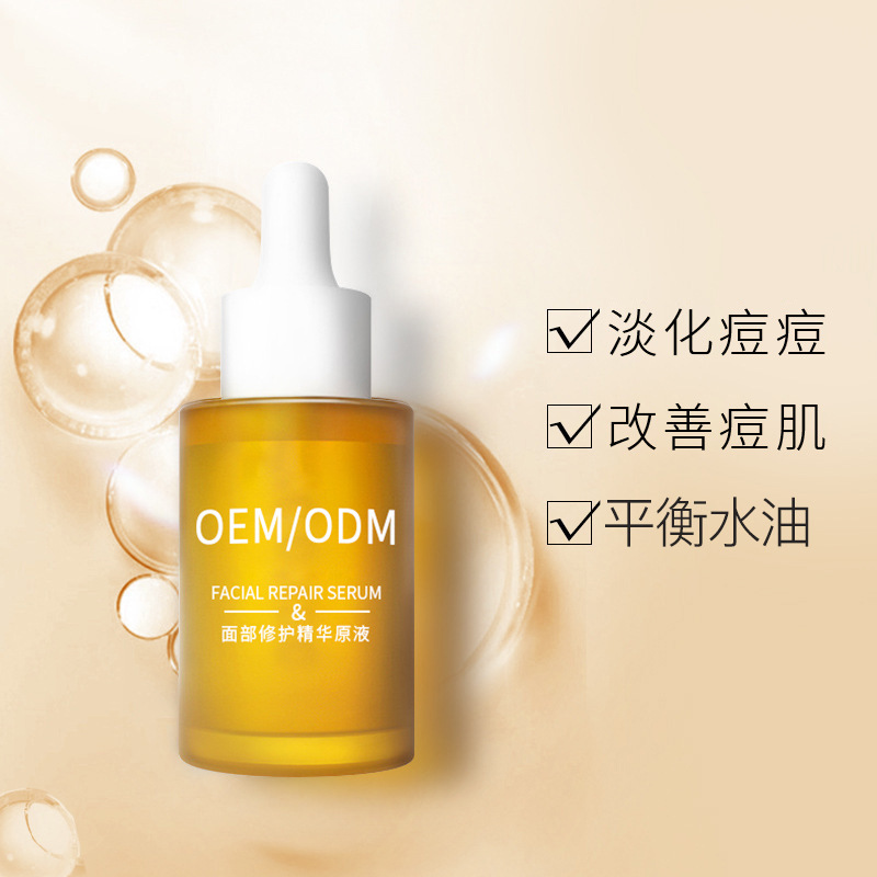 襄阳市_祛痘精华原液OEM